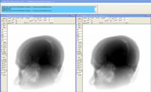 3D Radiographic Plot of a Human Brain